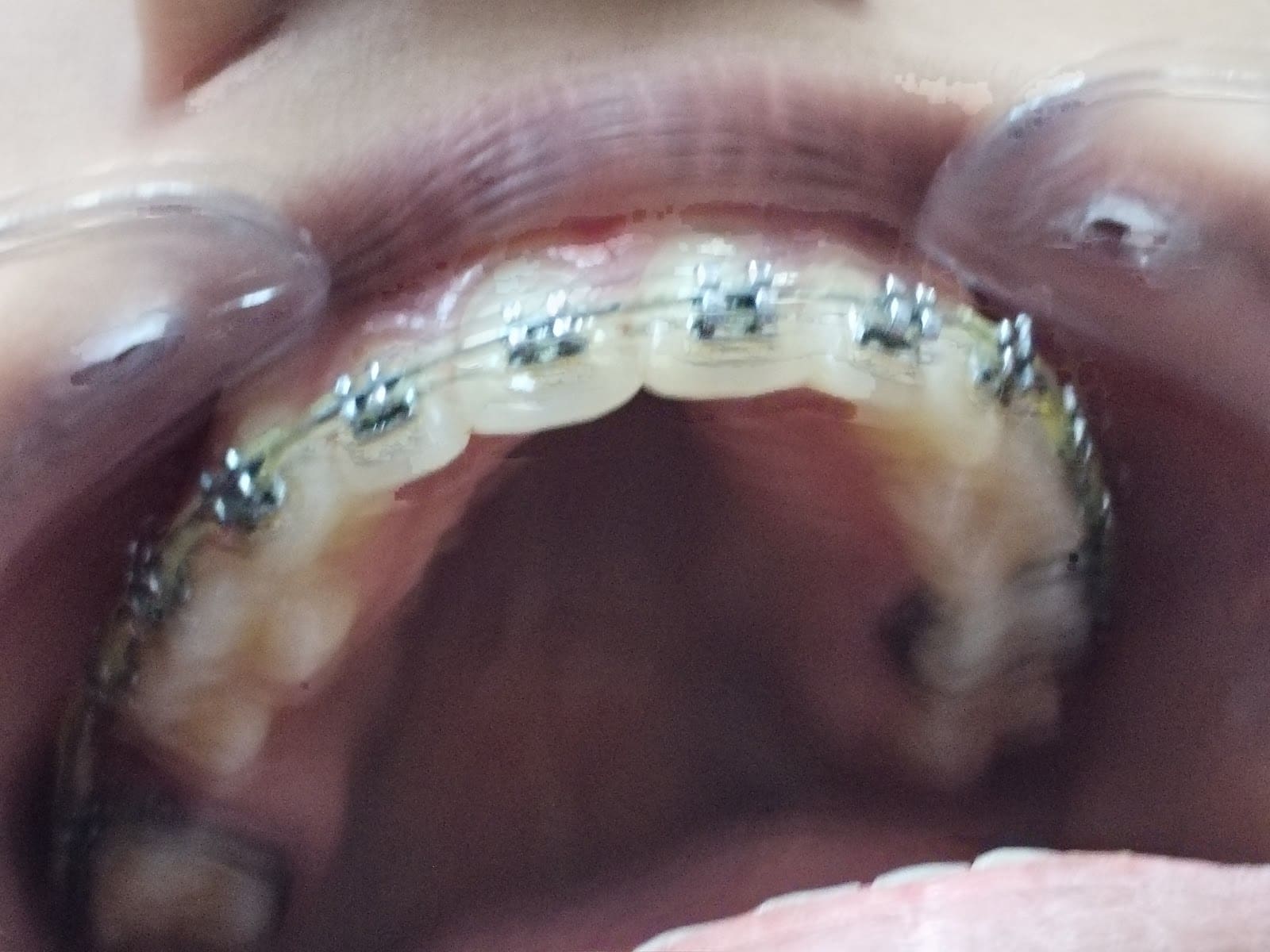 Dr. V.Dusoruth Dental clinic — Dentists