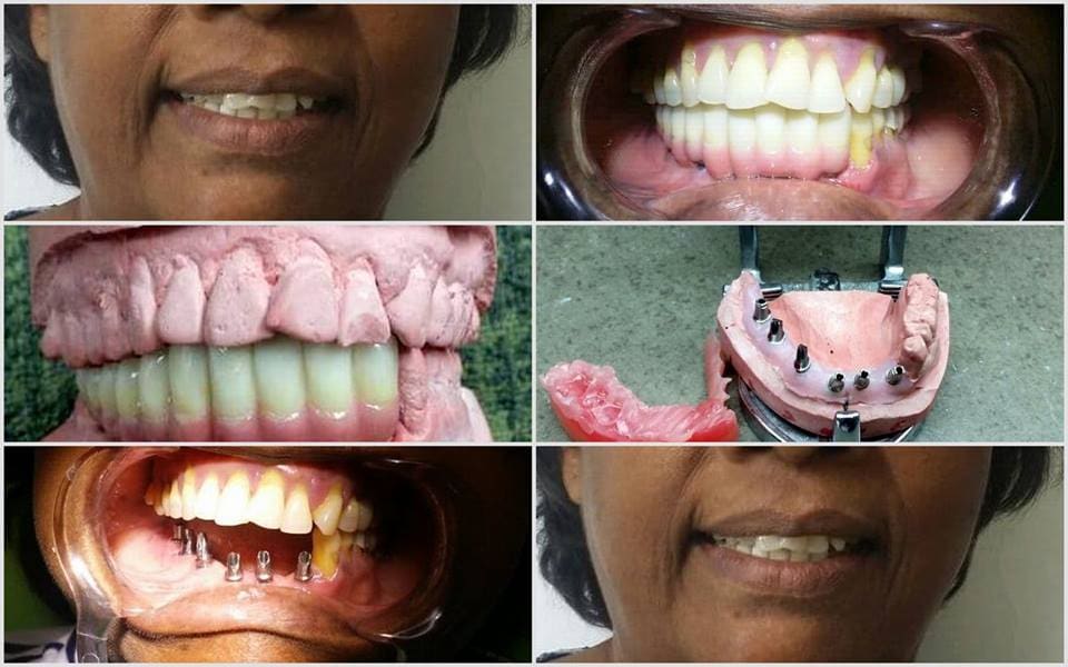 Modern Dental Care Trianon