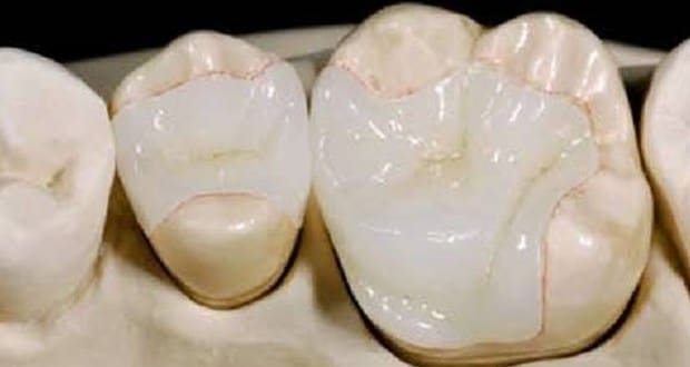 Modern Dental Care Trianon