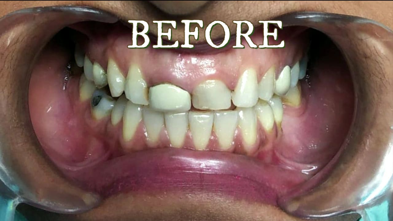 Modern Dental Care Trianon