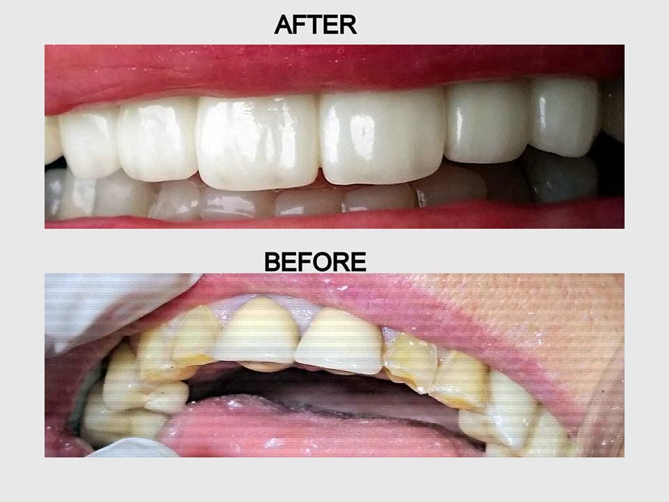 Modern Dental Care Trianon