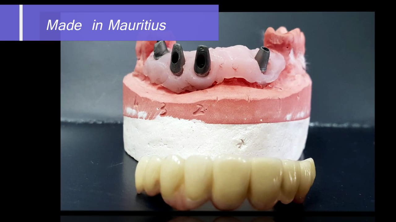 Modern Dental Care Trianon