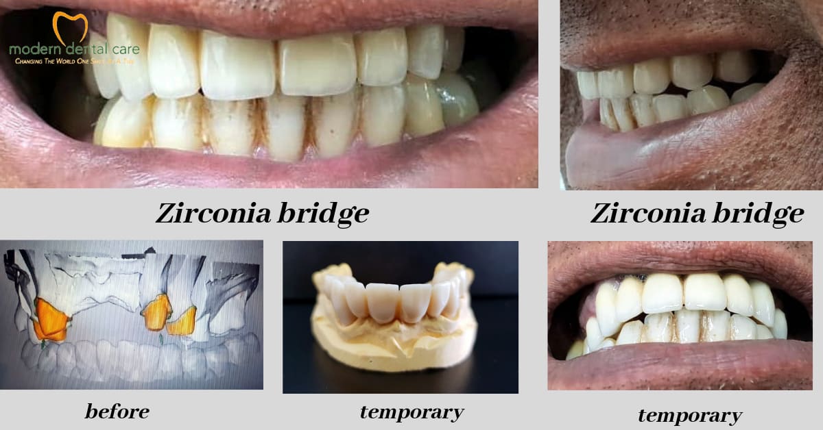 Modern Dental Care Trianon
