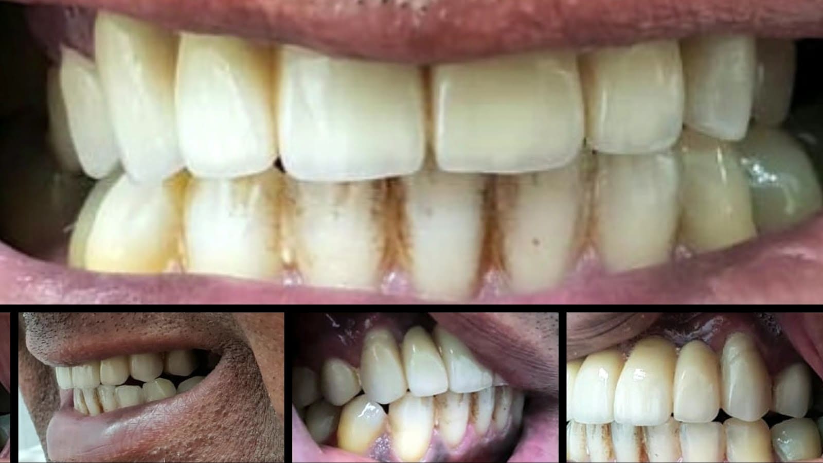 Modern Dental Care Trianon