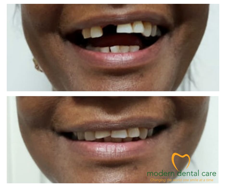 Modern Dental Care Trianon