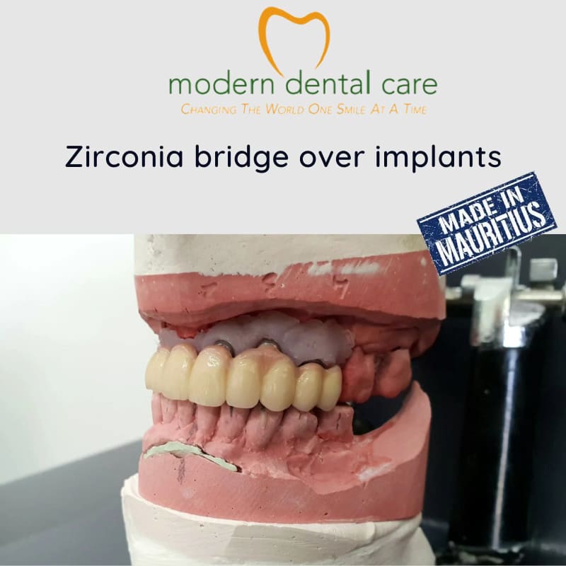 Modern Dental Care Trianon