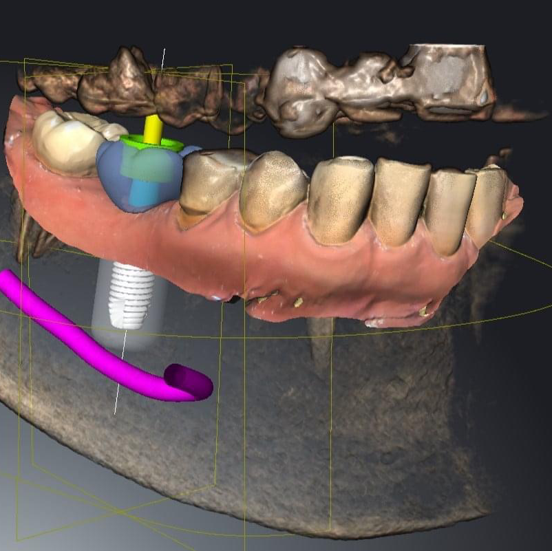 St Jean Dental Care - centre for digital dentistry and advanced dental implants - open 7 days.