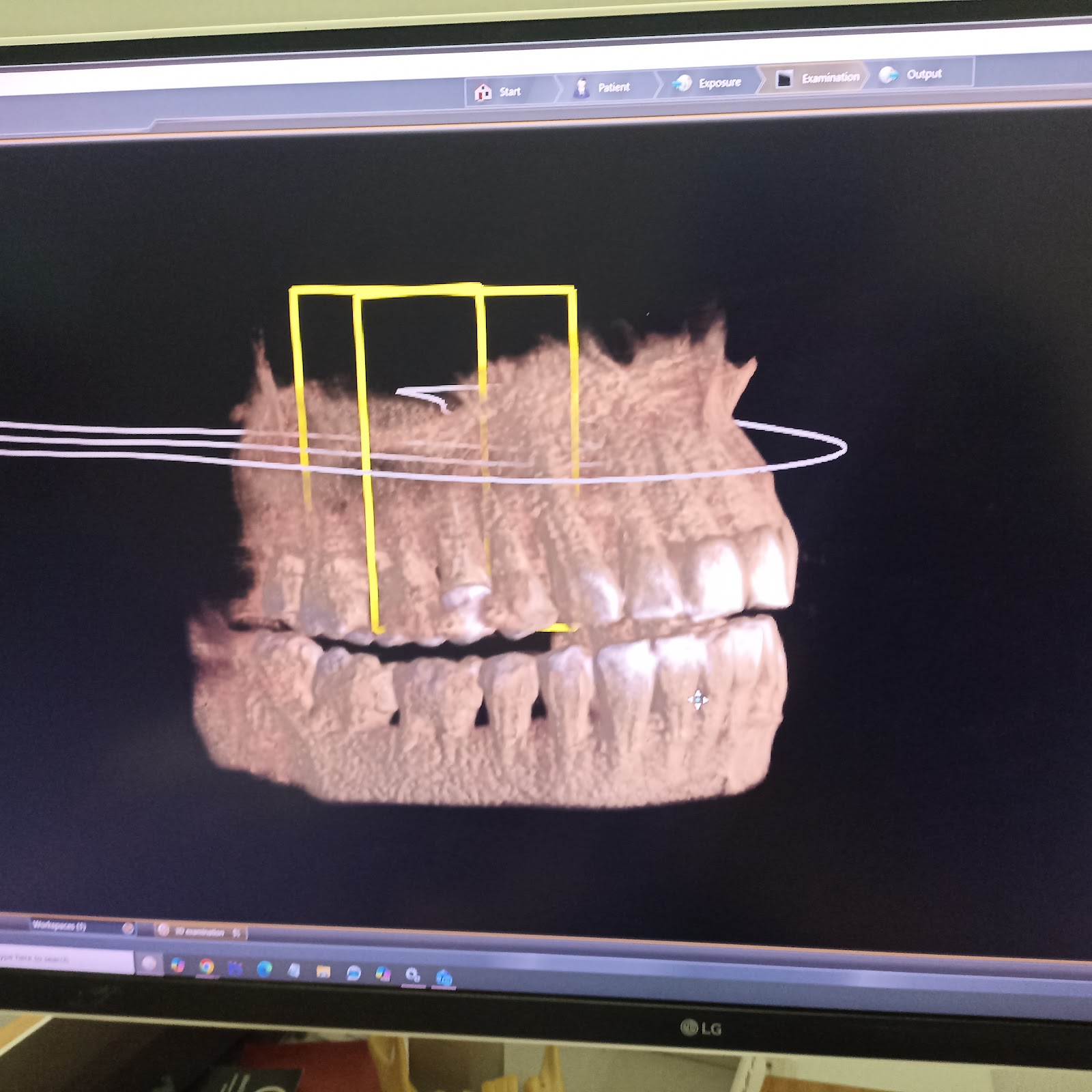 St Jean Dental Care - centre for digital dentistry and advanced dental implants - open 7 days.