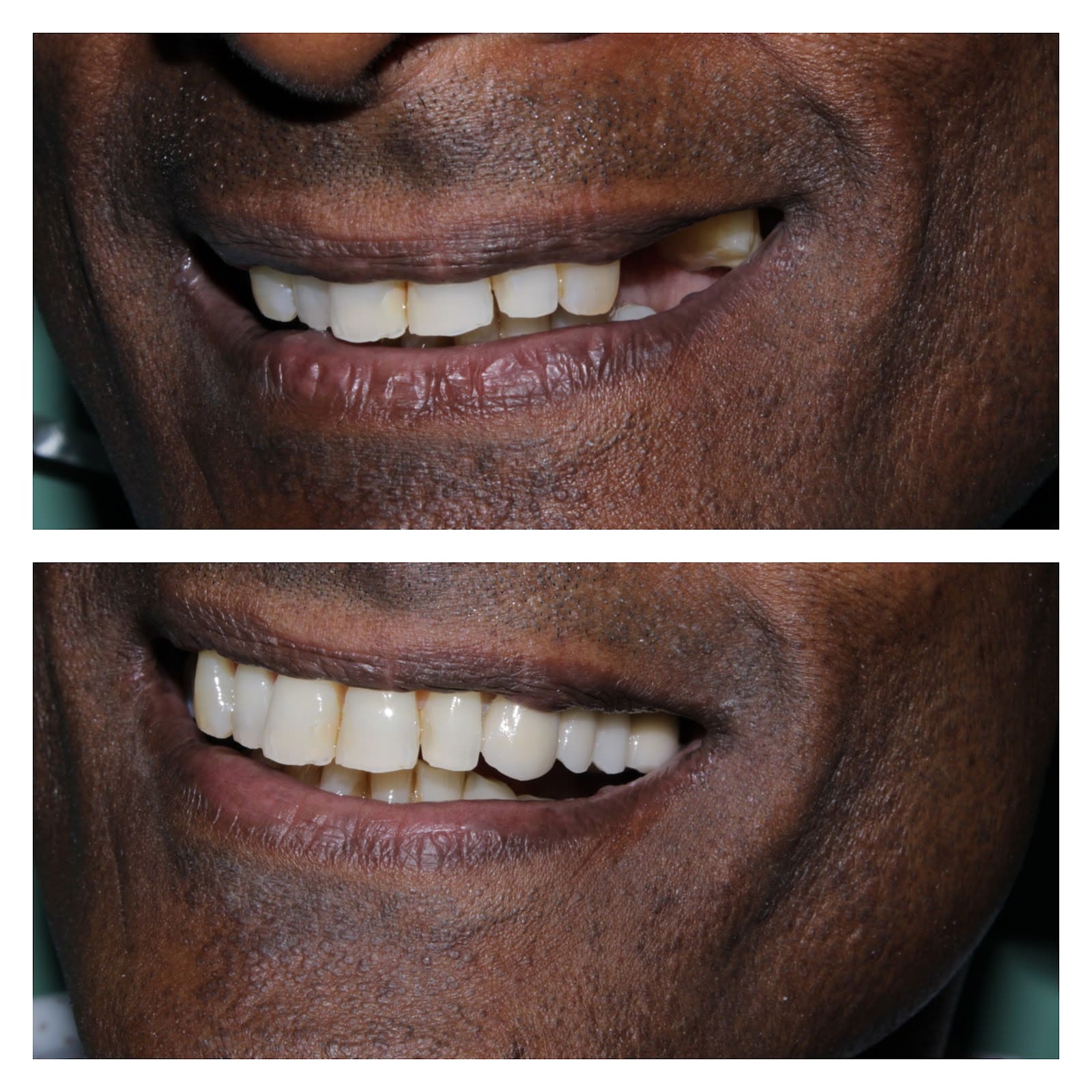 Dr. Ajay Raheja ( Family Dental Care)