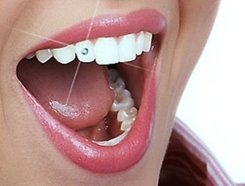 Dr Chandi Dental Clinic
