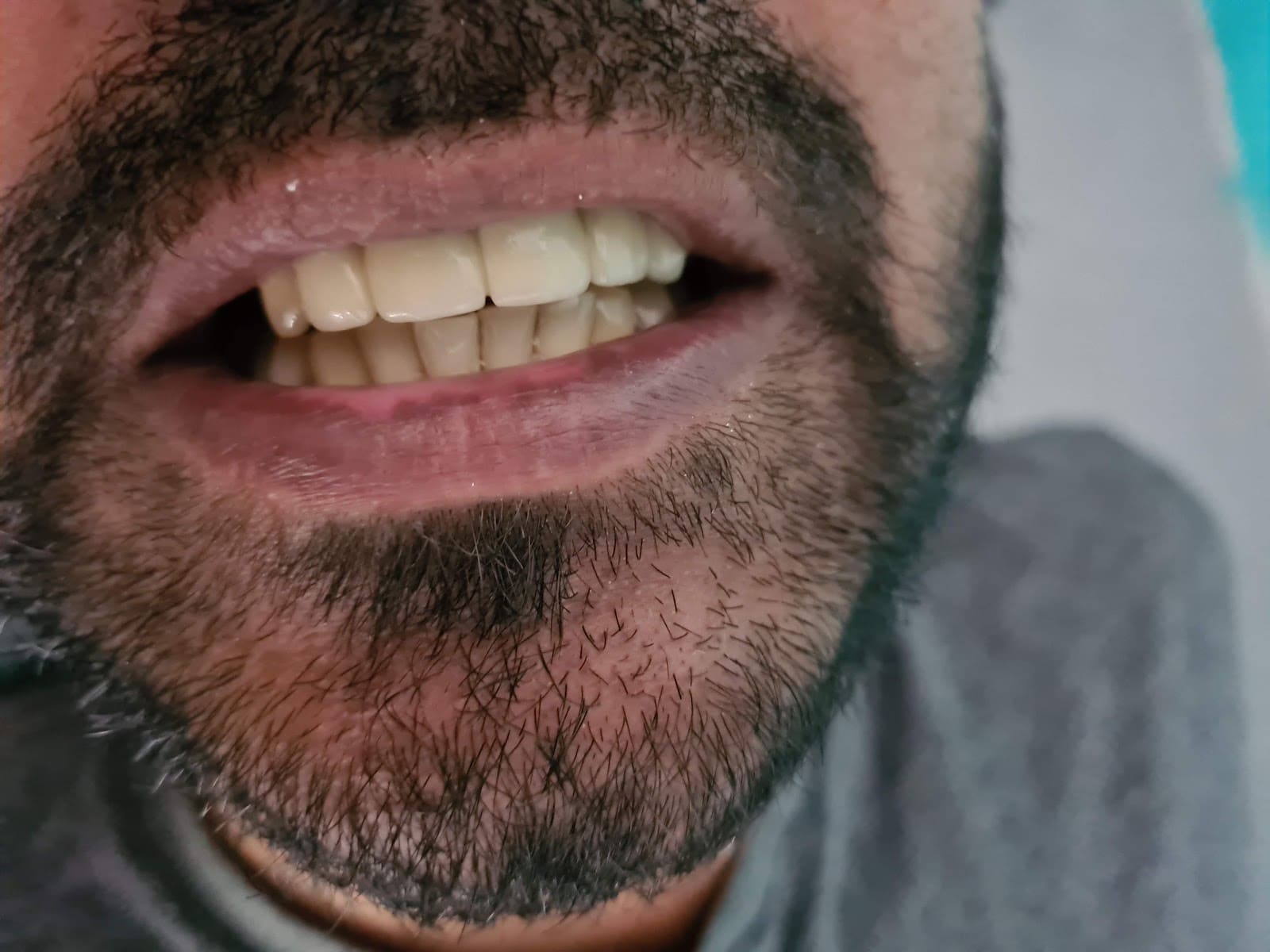 Smile Center