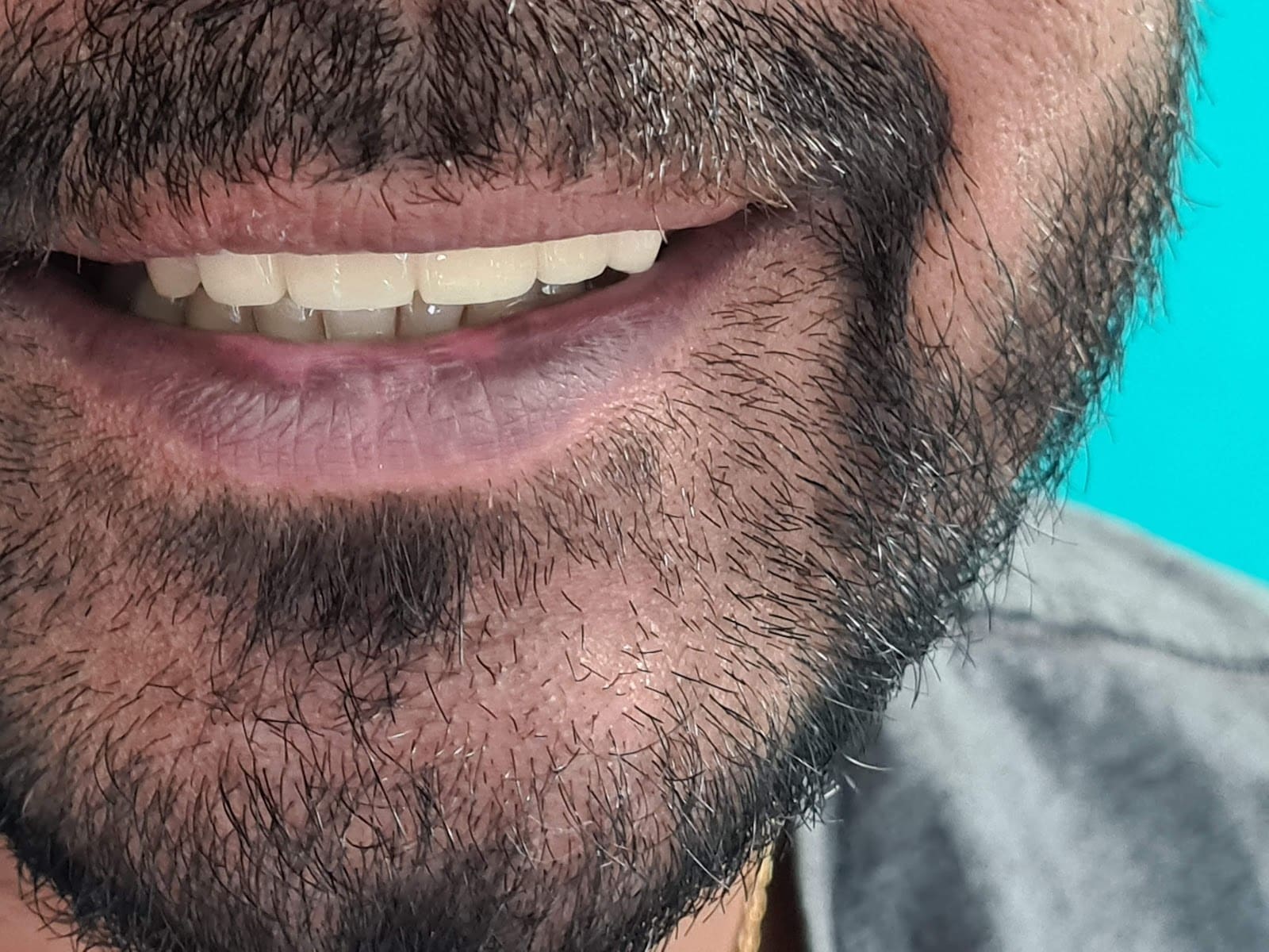 Smile Center